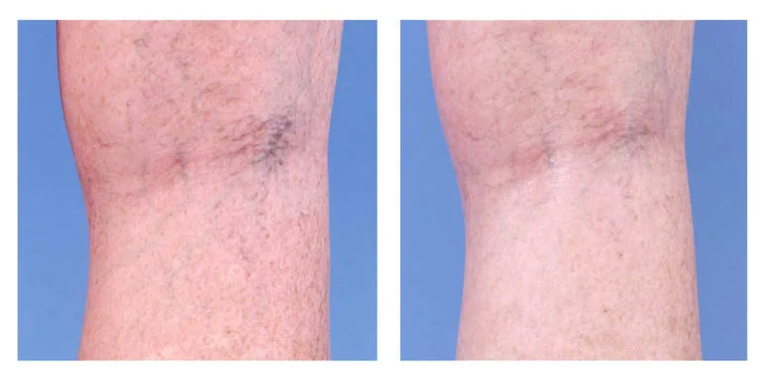 Zuzenketa kosmetikoa